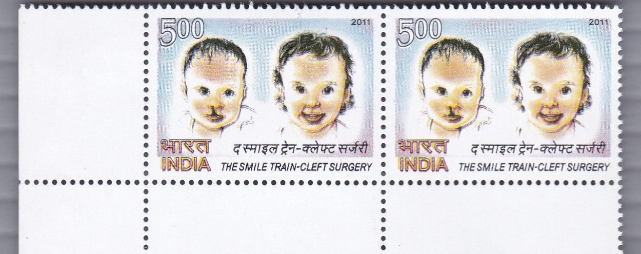 Yellow colour major shifted in Vertical strips.