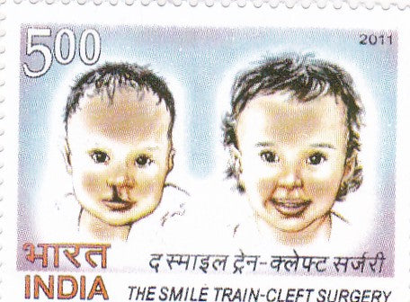 India Mint-2011 The Smile Train-cleft surgery.